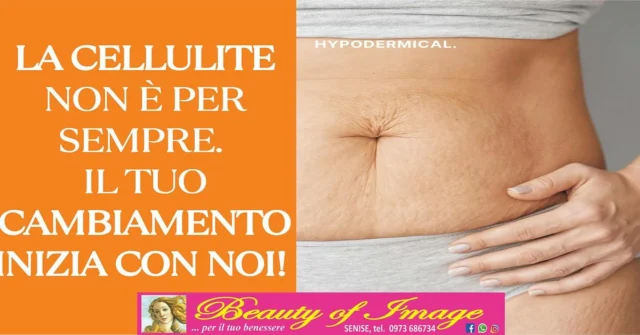 PRENOTA LA TUA CONSULENZA!!
☎️0973-686734
📱335-7282998